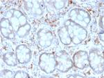 CD209/DC-SIGN (Pathogen Receptor on Dendritic Cells) Monoclonal Antibody (rC209/1781)