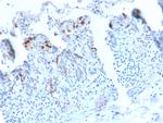 CD209/DC-SIGN (Pathogen Receptor on Dendritic Cells) Recombinant Rabbit Monoclonal Antibody (C209, 2749R)
