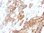 Heregulin-1/Neuregulin-1 (Breast and Urothelial Marker) Monoclonal Antibody (NRG1/2710)