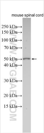 SLC6A20 Antibody in Western Blot (WB)