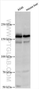 Egfr Antibody in Western Blot (WB)