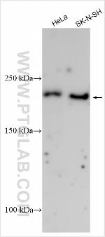 NPY5R Antibody in Western Blot (WB)