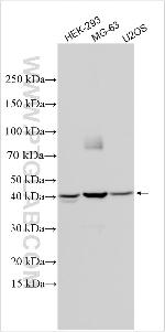 Collagen Type IV Antibody in Western Blot (WB)