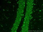 SSR3 Antibody in Immunohistochemistry (PFA fixed) (IHC (PFA))