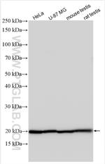 SSR3 Antibody in Western Blot (WB)