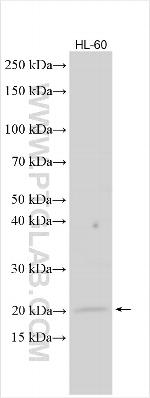 SETD4 Antibody in Western Blot (WB)