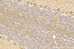 KIAA1715 Antibody in Immunohistochemistry (Paraffin) (IHC (P))