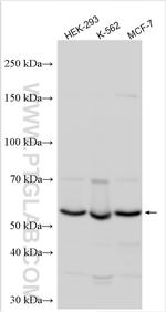 KIAA1715 Antibody in Western Blot (WB)