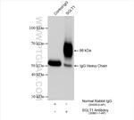 SGLT1 Antibody in Immunoprecipitation (IP)