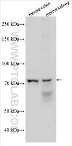 SGLT1 Antibody in Western Blot (WB)