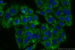 GPR52 Antibody in Immunocytochemistry (ICC/IF)