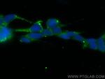 MEX3A Antibody in Immunocytochemistry (ICC/IF)