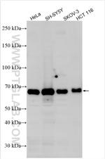 MEX3A Antibody in Western Blot (WB)