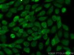 SGOL2 Antibody in Immunocytochemistry (ICC/IF)