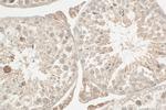 SGOL2 Antibody in Immunohistochemistry (Paraffin) (IHC (P))
