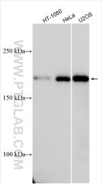 SGOL2 Antibody in Western Blot (WB)