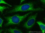 Timp1 Antibody in Immunocytochemistry (ICC/IF)