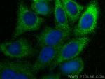 Timp1 Antibody in Immunocytochemistry (ICC/IF)