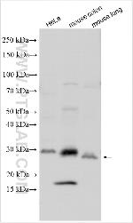 Osteoprotegerin/TNFRSF11B Antibody in Western Blot (WB)