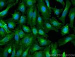CD147 Antibody in Immunocytochemistry (ICC/IF)