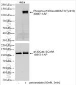 Phospho-p130Cas/BCAR1 (Tyr410) Antibody in Western Blot (WB)