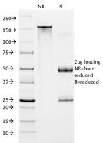 HIF1 alpha (Hypoxia-Inducible Factor 1-alpha) Monoclonal Antibody (ESEE122)