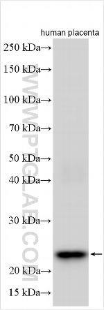 SCN4B Antibody in Western Blot (WB)