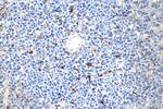 CD68 Antibody in Immunohistochemistry (Paraffin) (IHC (P))