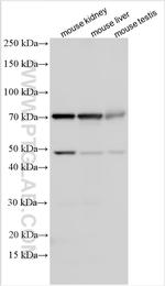 RNF180 Antibody in Western Blot (WB)
