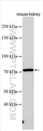 KIM-1/HAVCR1 Antibody in Western Blot (WB)