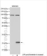 IL-6 Antibody in Western Blot (WB)