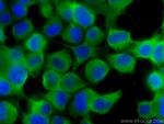 MIF Antibody in Immunocytochemistry (ICC/IF)