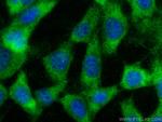 MIF Antibody in Immunocytochemistry (ICC/IF)
