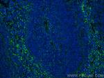 VCAM-1 Antibody in Immunohistochemistry (PFA fixed) (IHC (PFA))