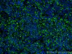 VCAM-1 Antibody in Immunohistochemistry (PFA fixed) (IHC (PFA))