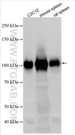 VCAM-1 Antibody in Western Blot (WB)
