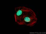 NCOA2 Antibody in Immunocytochemistry (ICC/IF)