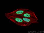 NCOA2 Antibody in Immunocytochemistry (ICC/IF)