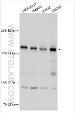 NCOA2 Antibody in Western Blot (WB)