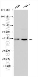 AGTR2 Antibody in Western Blot (WB)