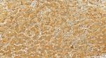 IL-1RAP Antibody in Immunohistochemistry (Paraffin) (IHC (P))