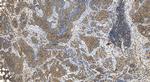 IL-1RAP Antibody in Immunohistochemistry (Paraffin) (IHC (P))