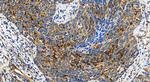 IL-1RAP Antibody in Immunohistochemistry (Paraffin) (IHC (P))