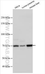 IL-1RAP Antibody in Western Blot (WB)