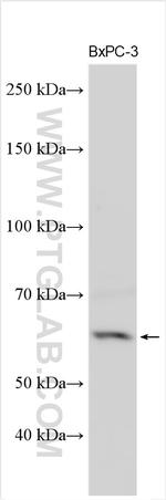 SLC6A9/GlyT1 Antibody in Western Blot (WB)