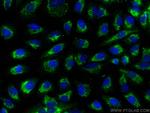 NLRP6 Antibody in Immunocytochemistry (ICC/IF)