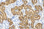 FMO1 Antibody in Immunohistochemistry (Paraffin) (IHC (P))