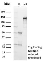 HK1/Hexokinase 1 Antibody in SDS-PAGE (SDS-PAGE)