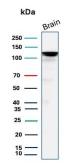 HK1/Hexokinase 1 Antibody in Western Blot (WB)