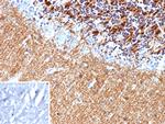 HK1/Hexokinase 1 Antibody in Immunohistochemistry (Paraffin) (IHC (P))